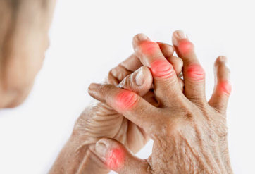 손가락 마디통증