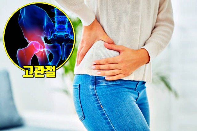 고관절 통증, 생로병사의 비밀, 보폭 10cm 더 넓혀 걷기 운동 효과, 건강, 팁줌마 매일꿀정보