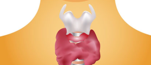 갑상선암 초기증상 갑상선암 수술비용