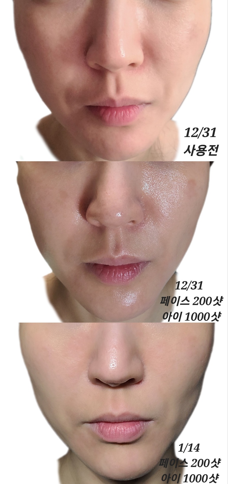듀얼소닉5