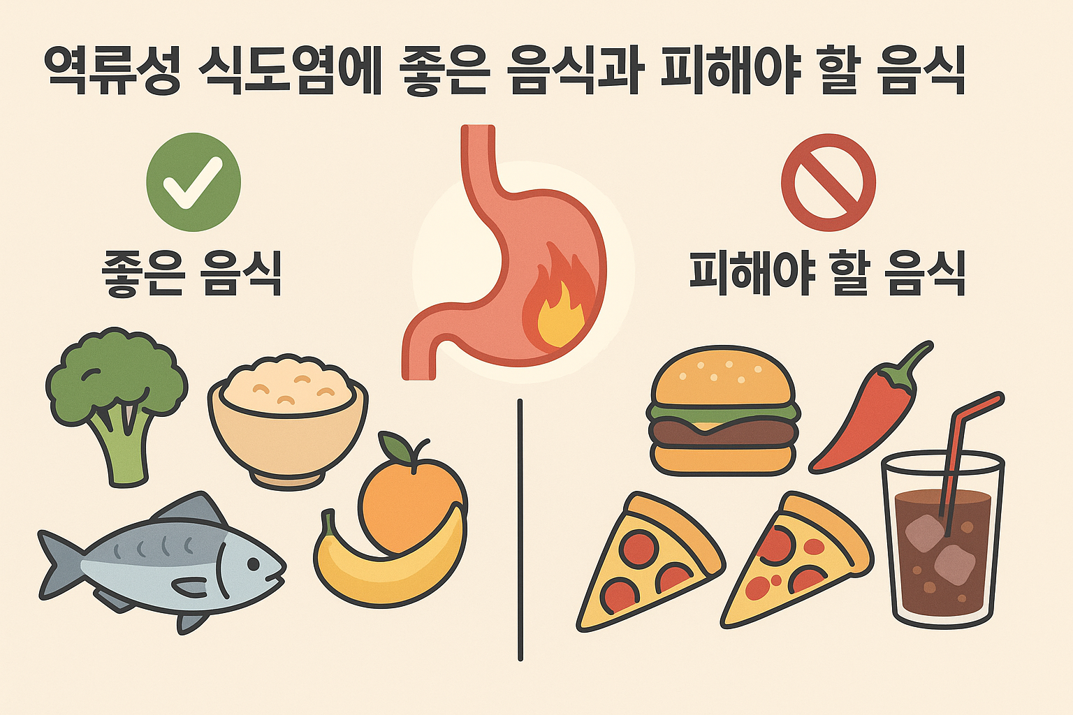 역류성 식도염