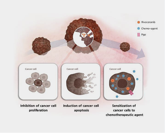 간암 신약 리보세라닙 승인