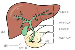 담도암에 좋은 음식