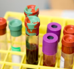 고지혈증에 좋은 음식 나쁜 음식