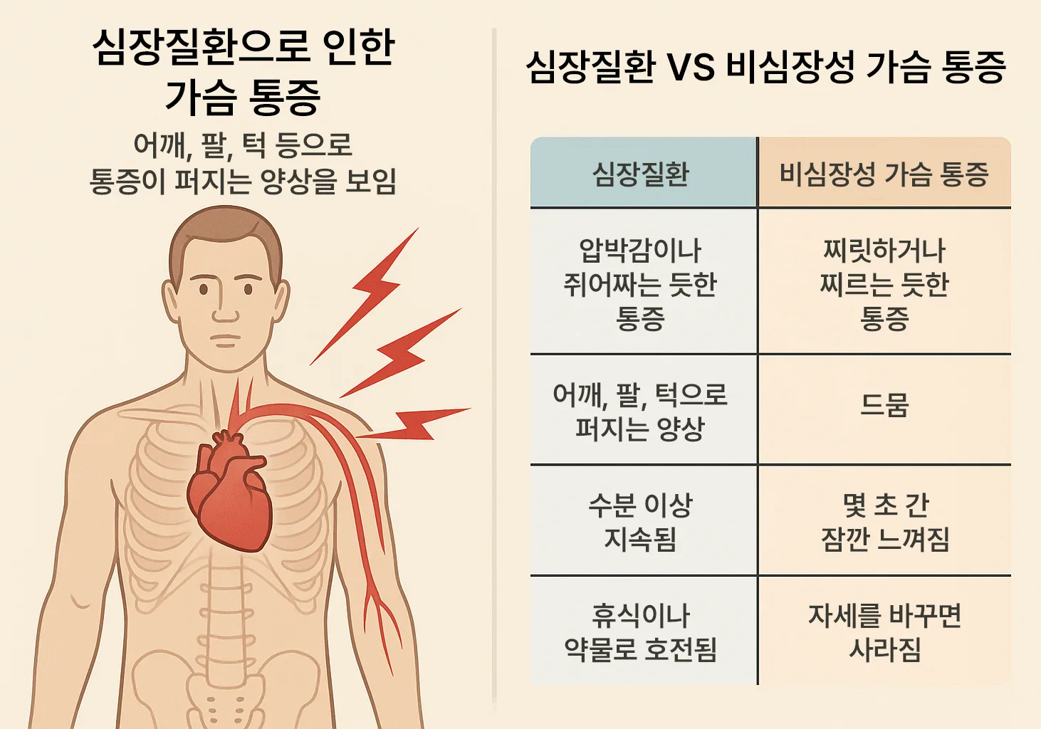어깨&middot;팔&middot;턱으로 퍼지는 방사통 경로 강조, 심장성 vs 비심장성 가슴 통증의 차이