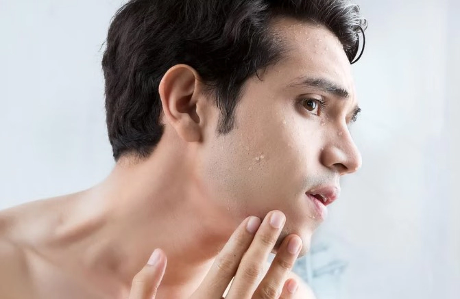 모공 줄이는 방법