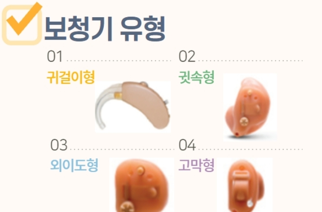 보청기를 4가지 유형으로 분류한 그림 이미집니다.