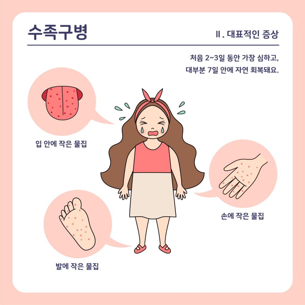 수족구