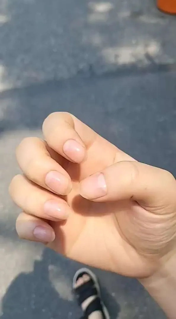 네일봐&#44; 쑴