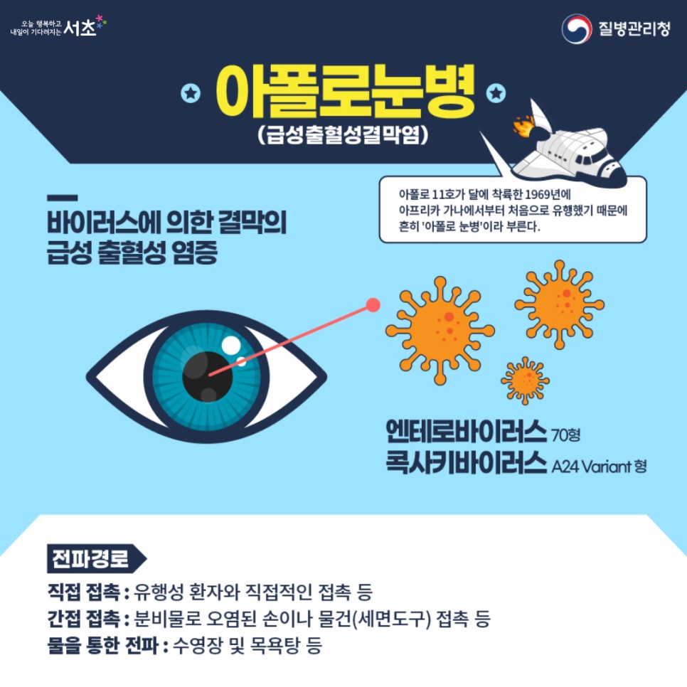 아폴로눈병