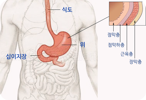 시서스-효능