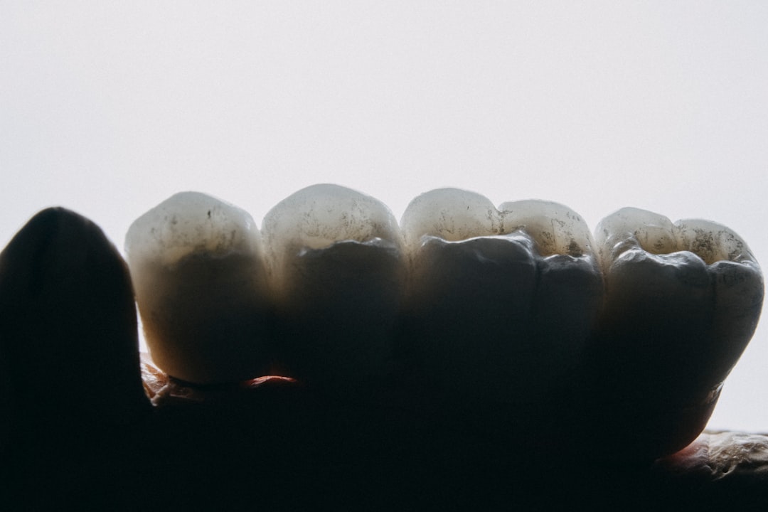 Implant