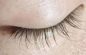 눈꺼풀 떨림 현상