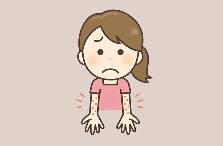 알레르기가-심한-여성