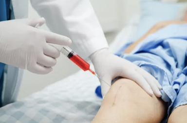 무릎 연골 치료 사진