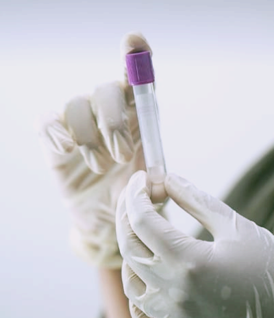 혈액암 증상과 초기증상, 생존율은?