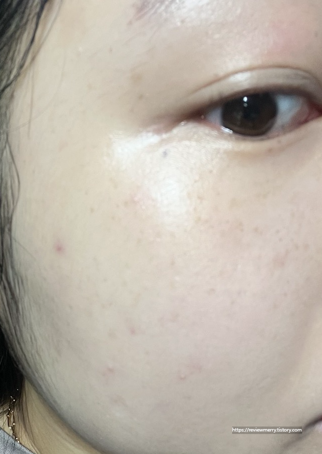 메이크업 후 우측 볼 사진