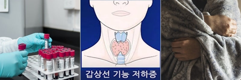 갑상선 기능 저하증, 혈액 검사, 오한 증상