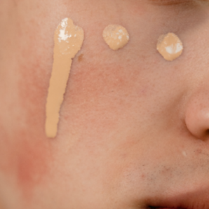 다크 서클 피부과 컨실러 화장법