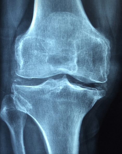 서리태 효능과 관련된 사진 - 3