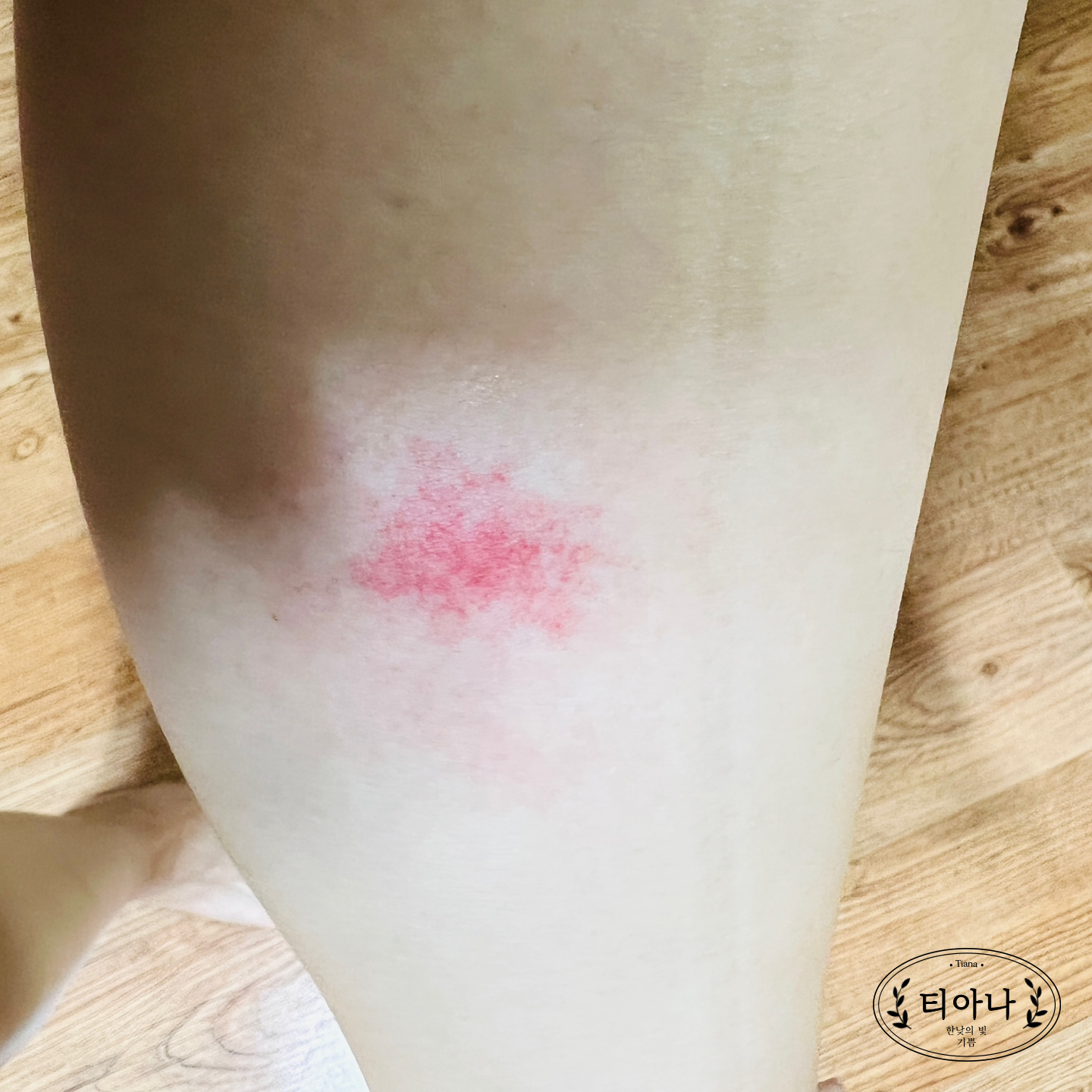 내가 당질 제한식을 선택하게 된 이유