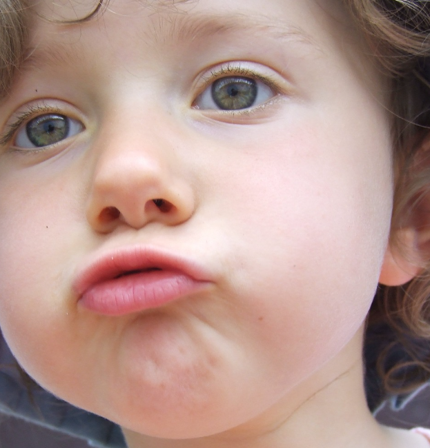 구내염 증상과 예방방법