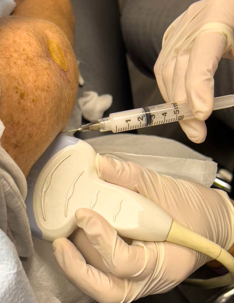 관절염 주사 사진