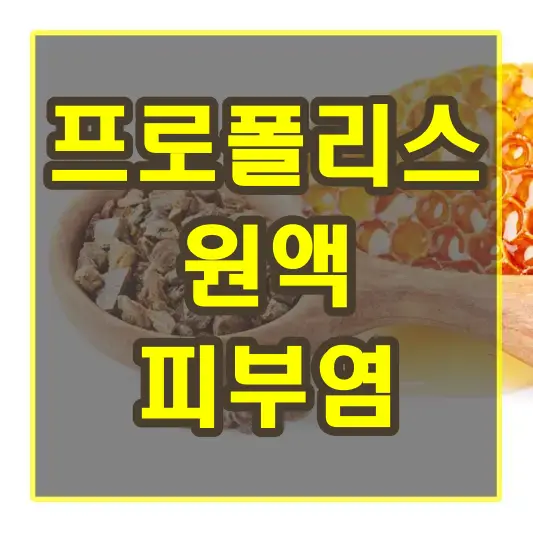 프로폴리스 원액 피부염