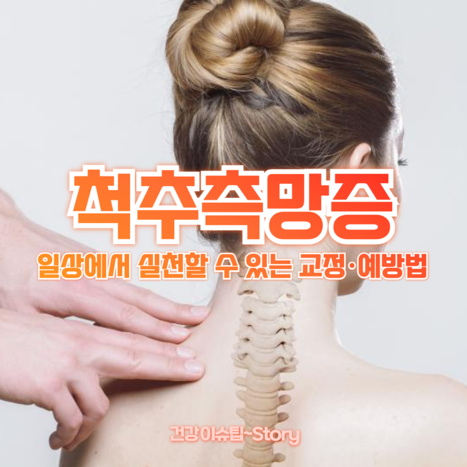 척추측망증