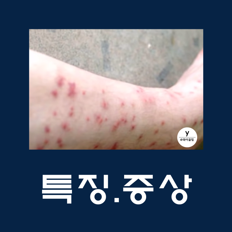 모래파리에 의해 물림 상처