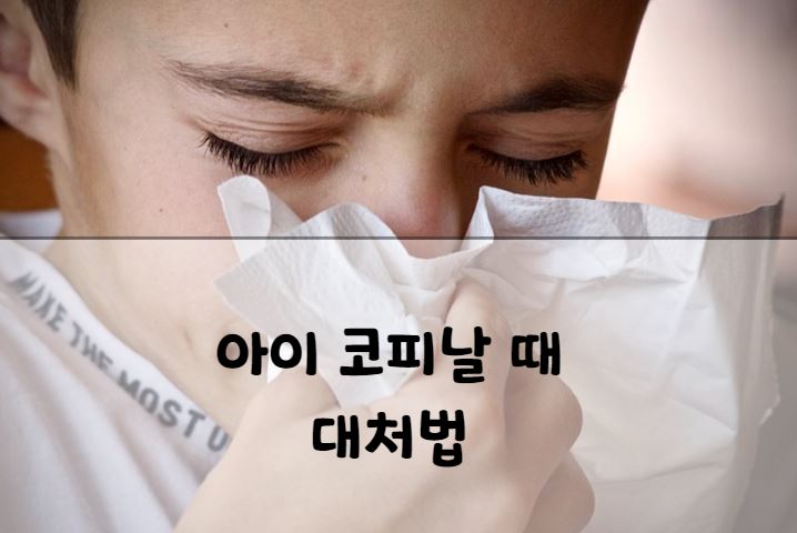 아이 코피