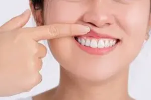 치아