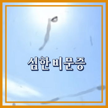 눈 검은것이떠다니는것
