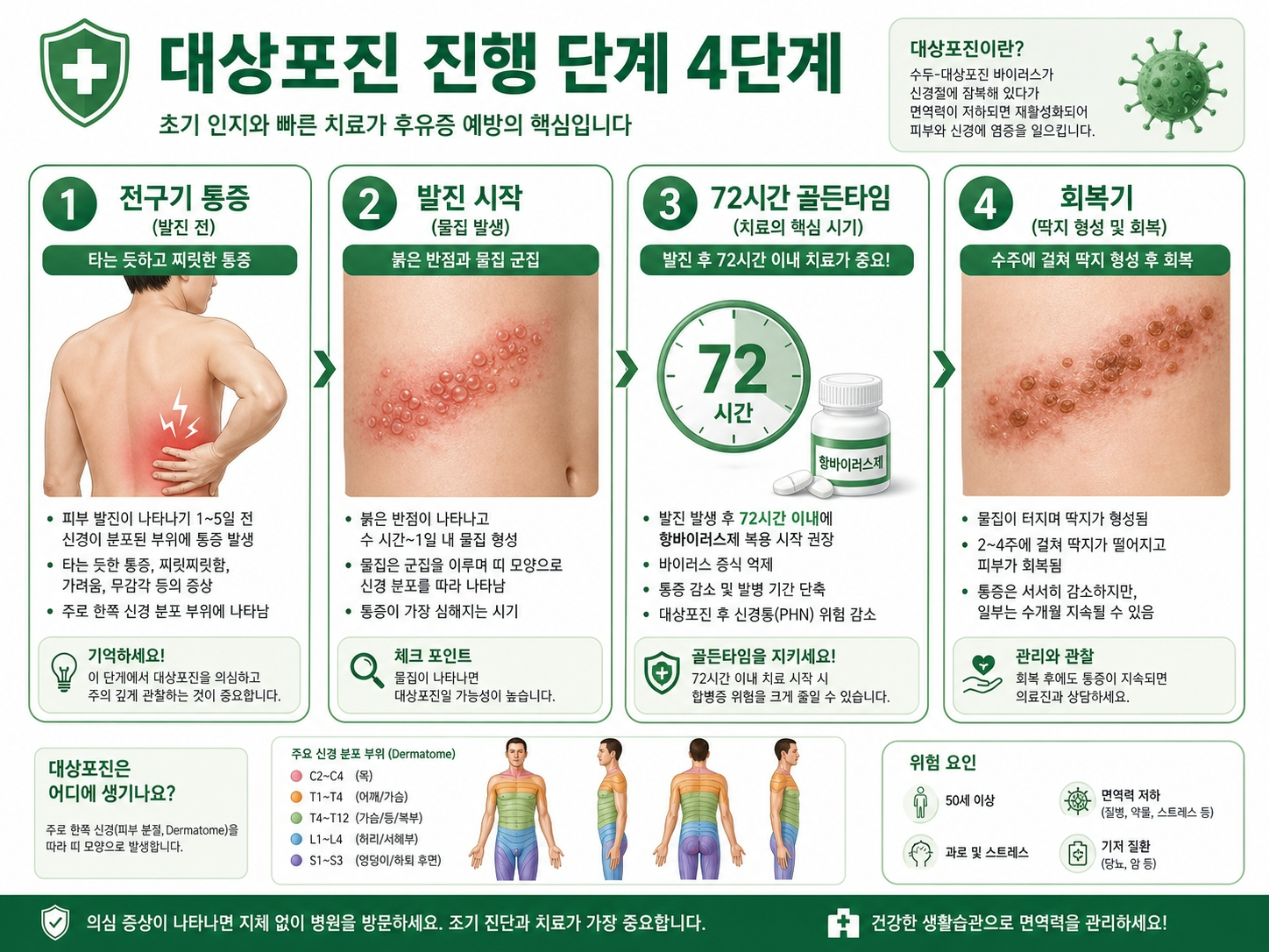 대상포진 초기증상 진행 단계 72시간 골든타임