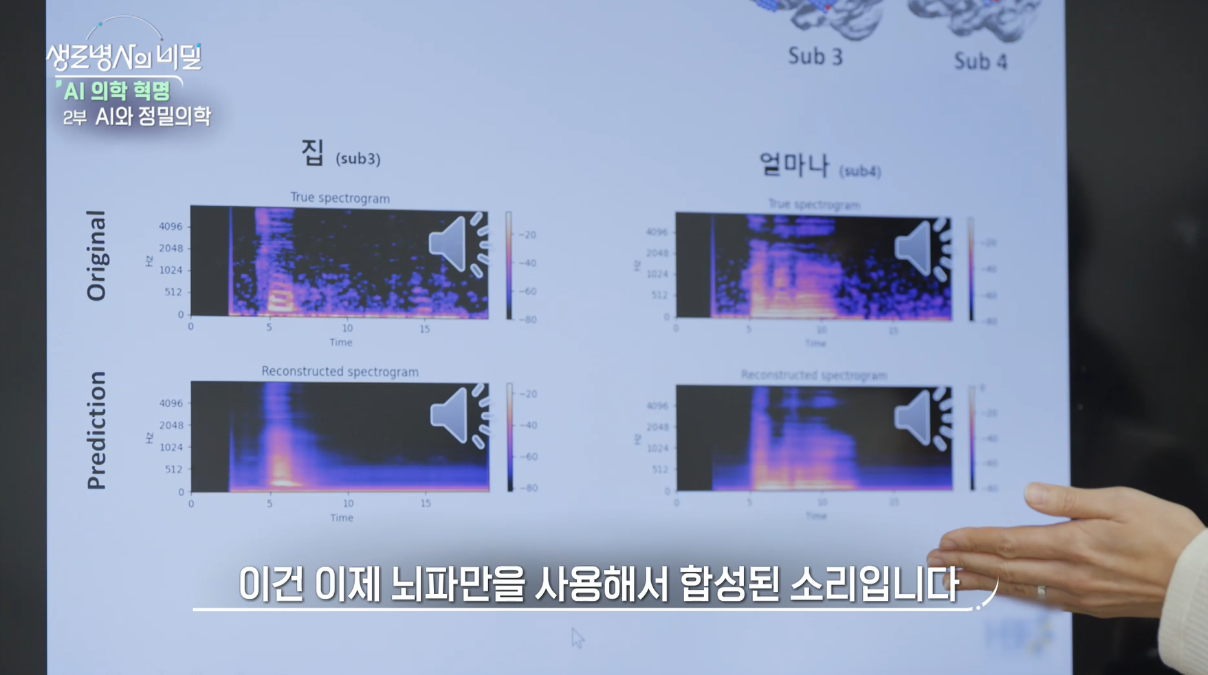 생로병사의 비밀 AI 정밀의학