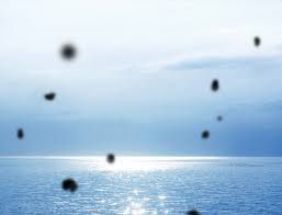 비문증 치료방법