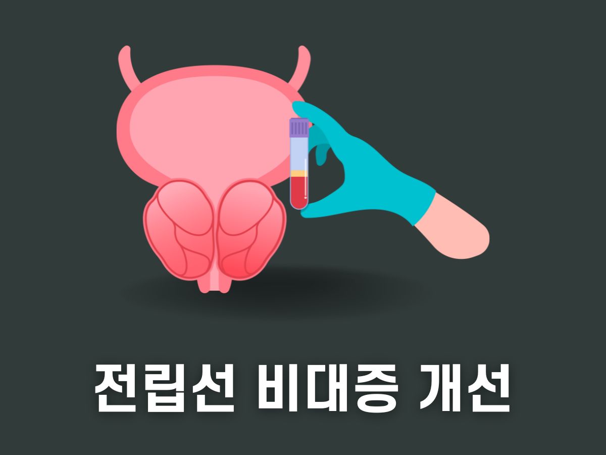 전립선 비대증 개선제