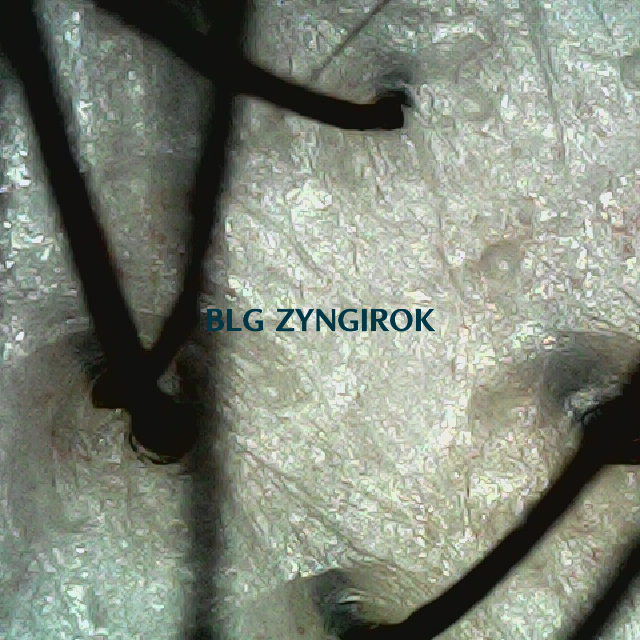 탈모 극복 프로젝트 - 뒷머리 두피 모습이다.