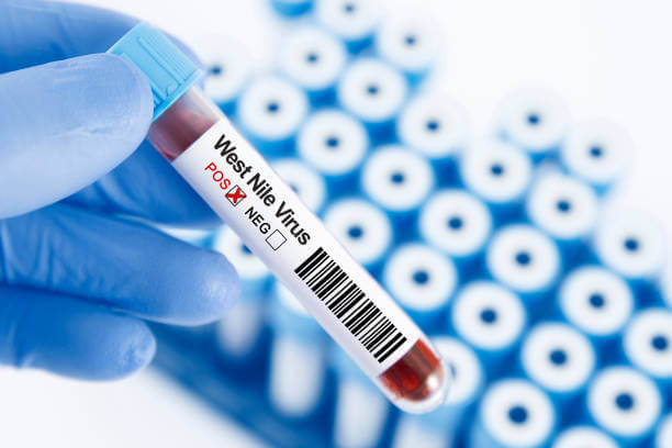  웨스트나일 바이러스 감염 