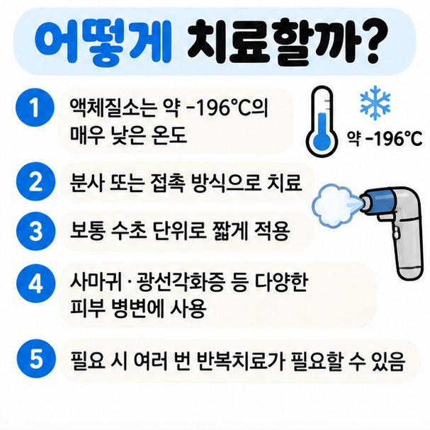 액체질소 약 영하 196도 분사 또는 접촉 수초 시술 사마귀와 광선각화증 등 치료 대상을 정리한 이미지