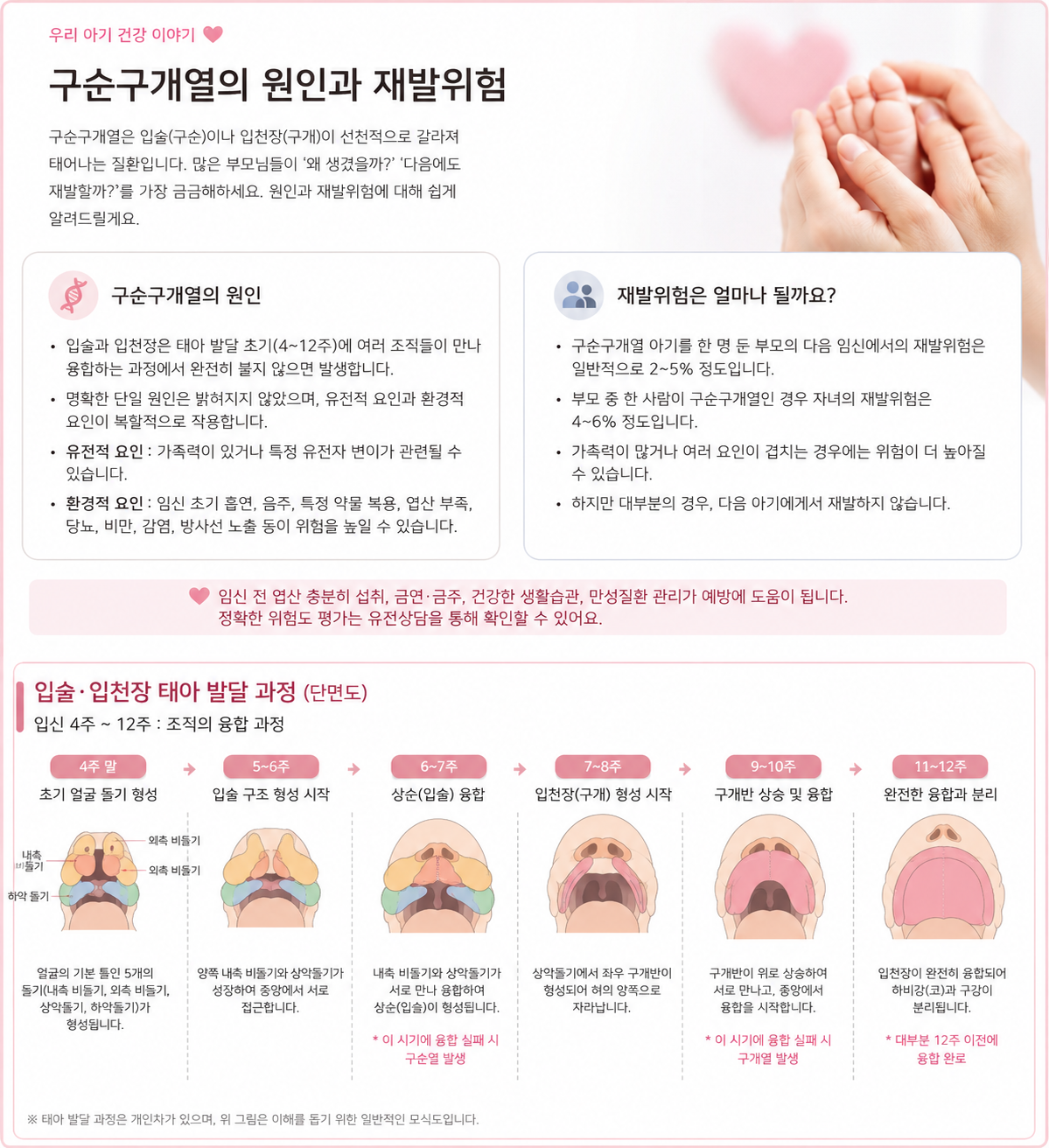 구순구개열 원인과 재발위험도 인포그래픽