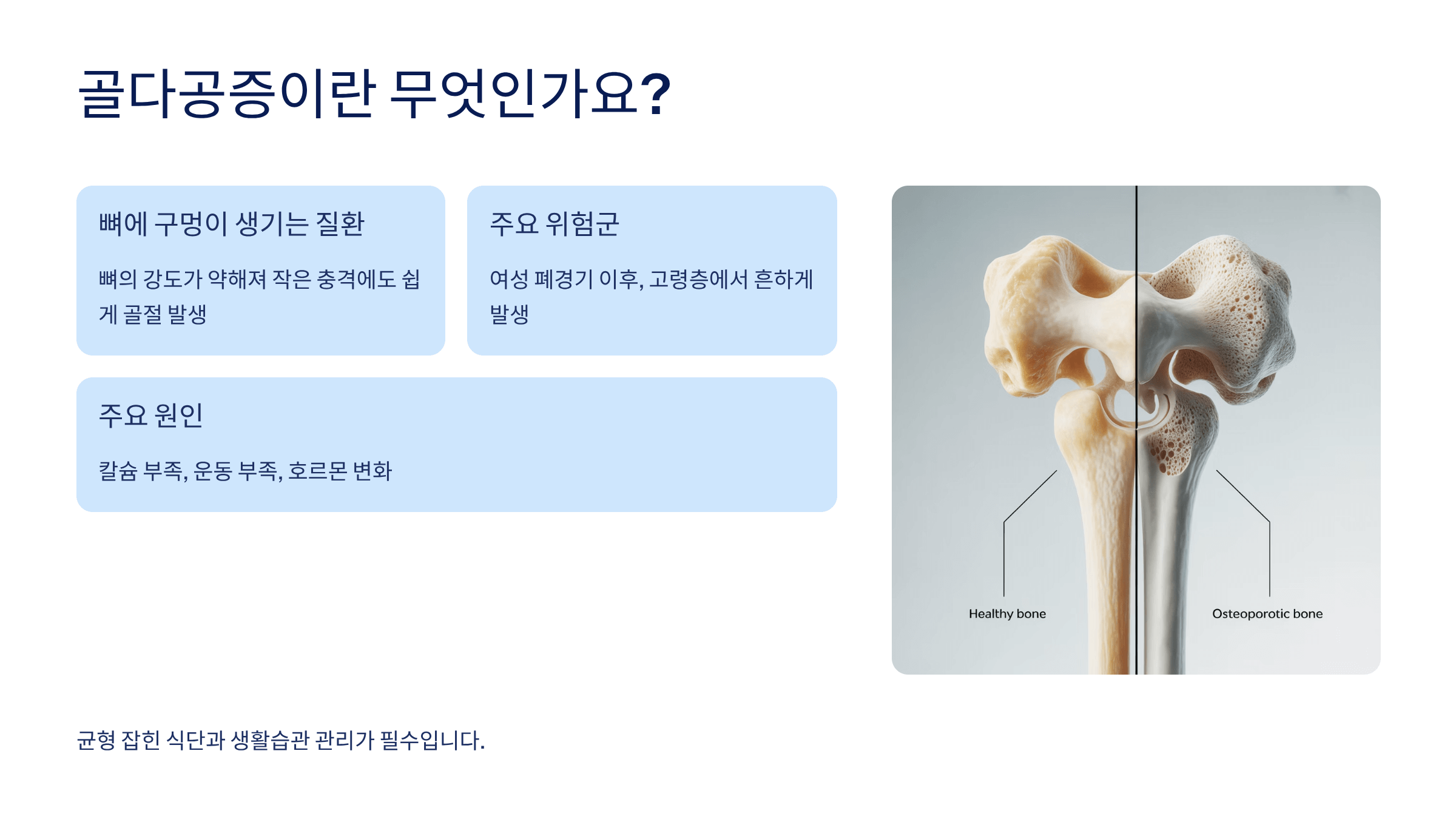 골다공증에 좋은 음식