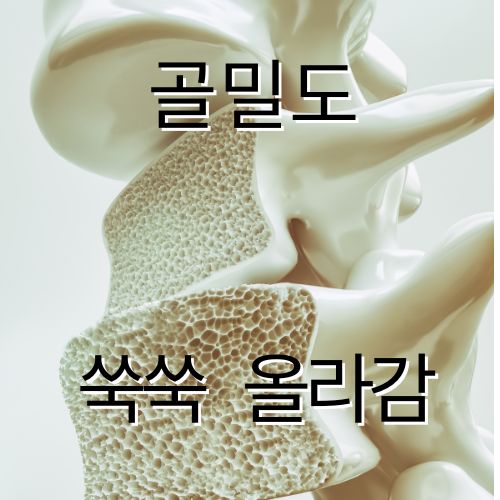 골다공증 증상 및 치료