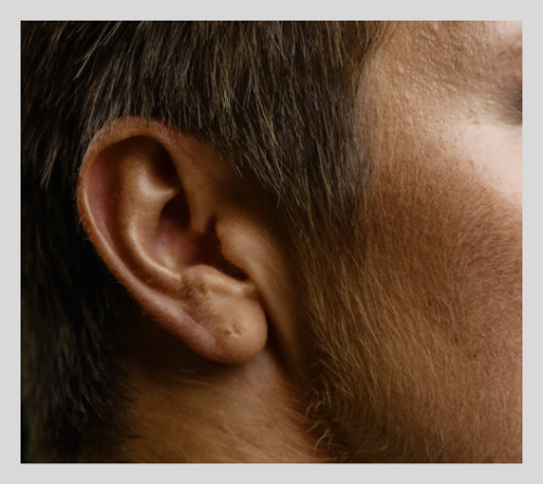 귀이명 증상과 관리에 좋은 영양제 총정리