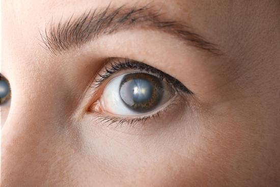 눈매 교정술(Eyelid Correction Surgery): 아름답고 또렷한 눈매를 위한 수술