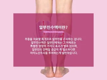 알부민 수액 알부민 링거 가격까지 한번에 정리로_25