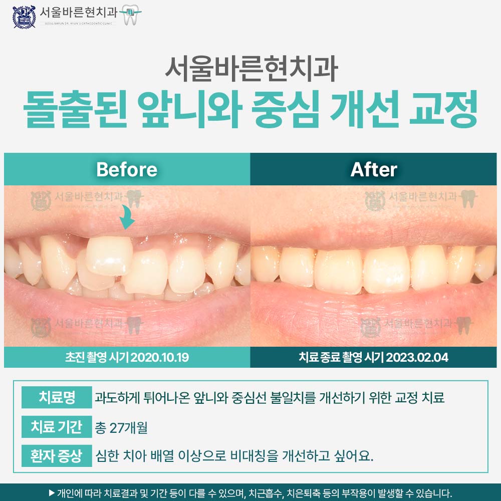 해운대교정치과