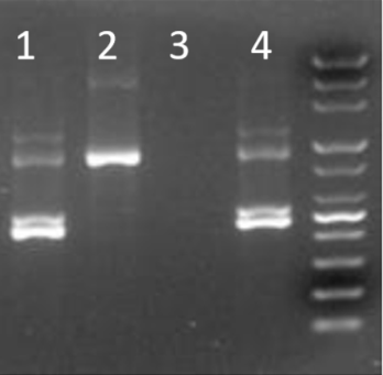 급성골수성백혈병 원인, 증상, 진단, 치료방법