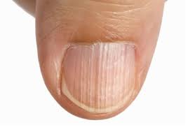 손톱 색깔로 보는 건강