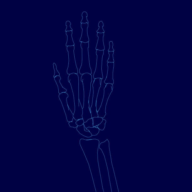 척골충돌증후군 원인